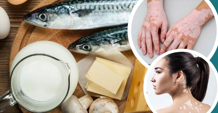 মাছ ভাত খাওয়ার পরপরই দুধ খেলে শরীরে যা ঘটে